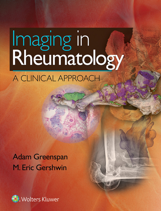 Imaging in Rheumatology A Clinical Approach ebook cover