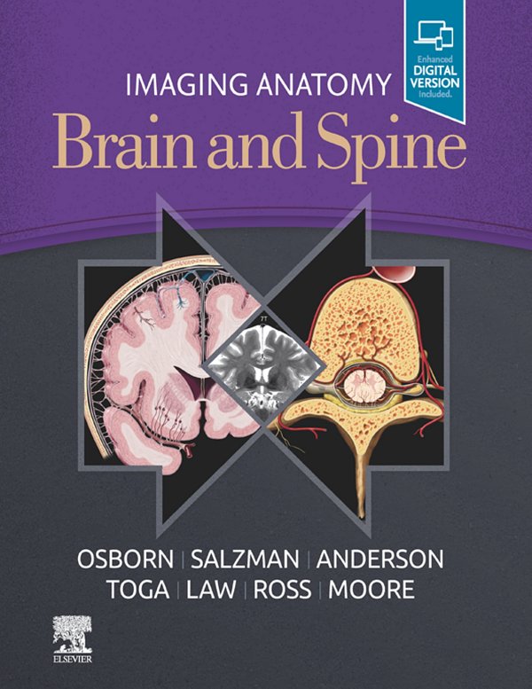 IMAGING ANATOMY: Brain and Spine ebook cover