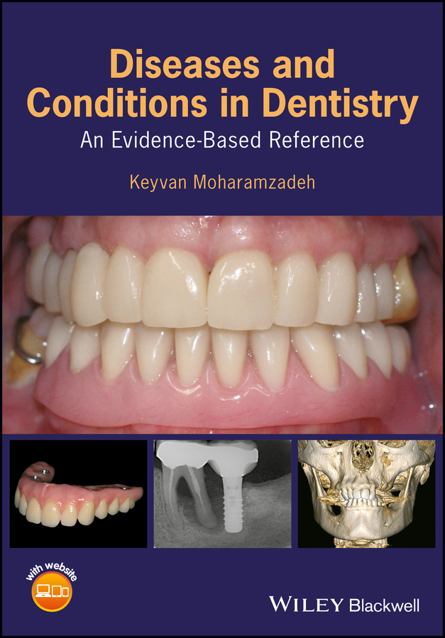 Diseases and Conditions in Dentistry ebook cover