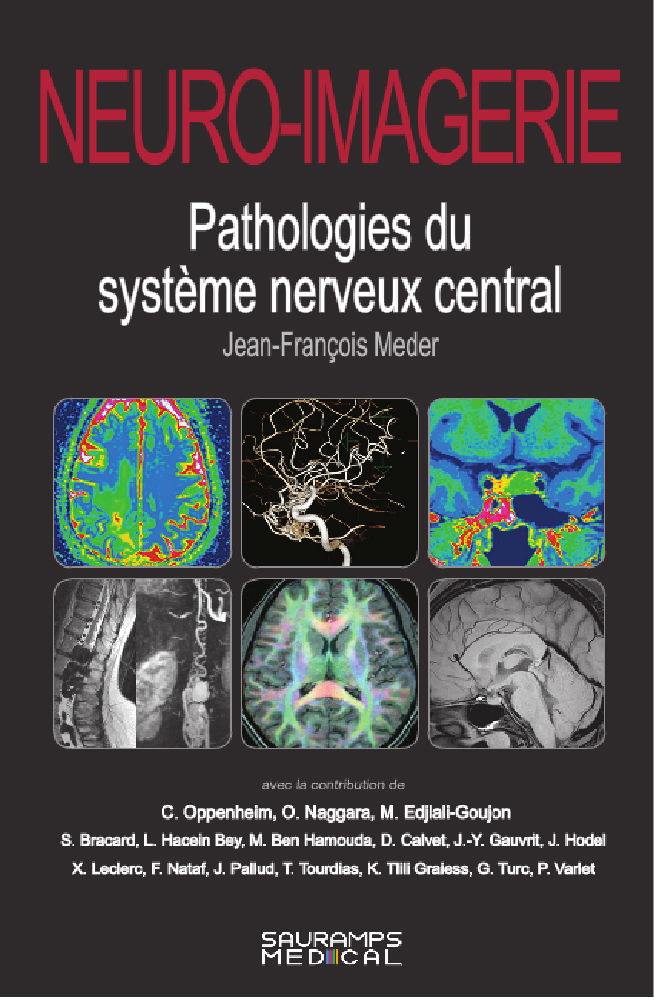 NEURO-IMAGERIE ebook cover