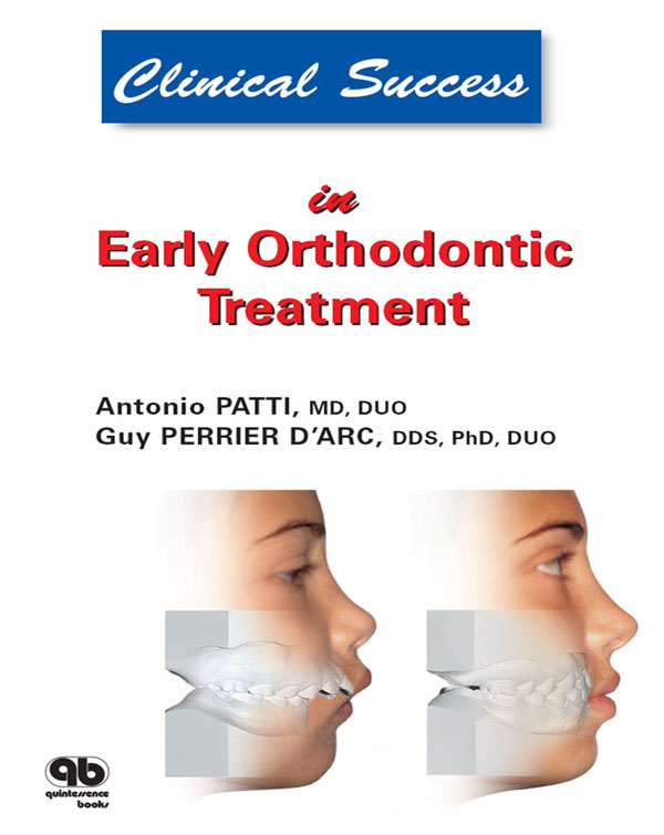 Early Orthodontic Treatment ebook cover