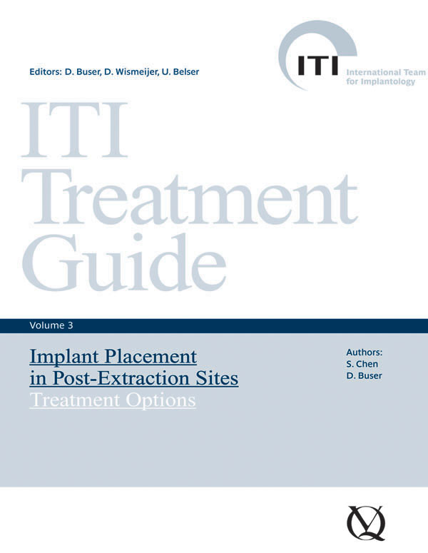 ITI Treatment Guide 3 ebook cover