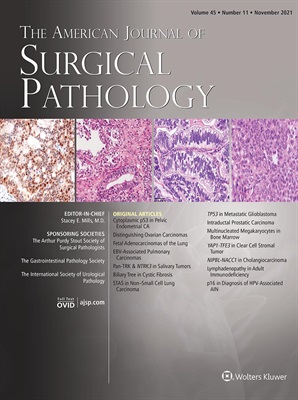 Use of Monoclonal Antibody Against Human Inhibin as a Marker  for Sex Cord-Stromal Tumors of the Ovary ebook cover